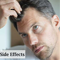 How to decrease side effects of Finasteride?