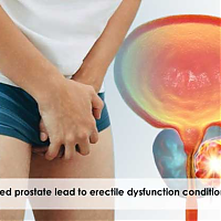 Can an enlarged prostate lead to erectile dysfunction condition?