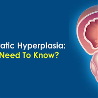 Benign Prostatic Hyperplasia: What You Need To Know?