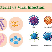 Bacterial vs Viral Infection: Know the Difference