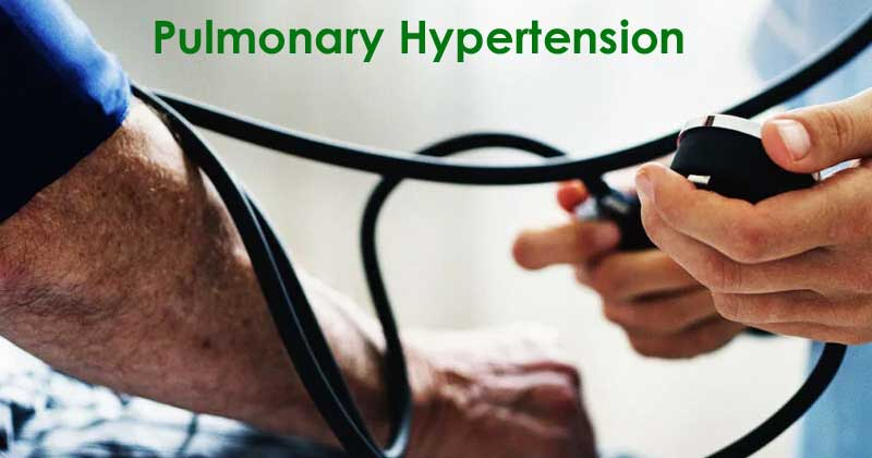 Pulmonary Hypertension: Everything You Need to Know
